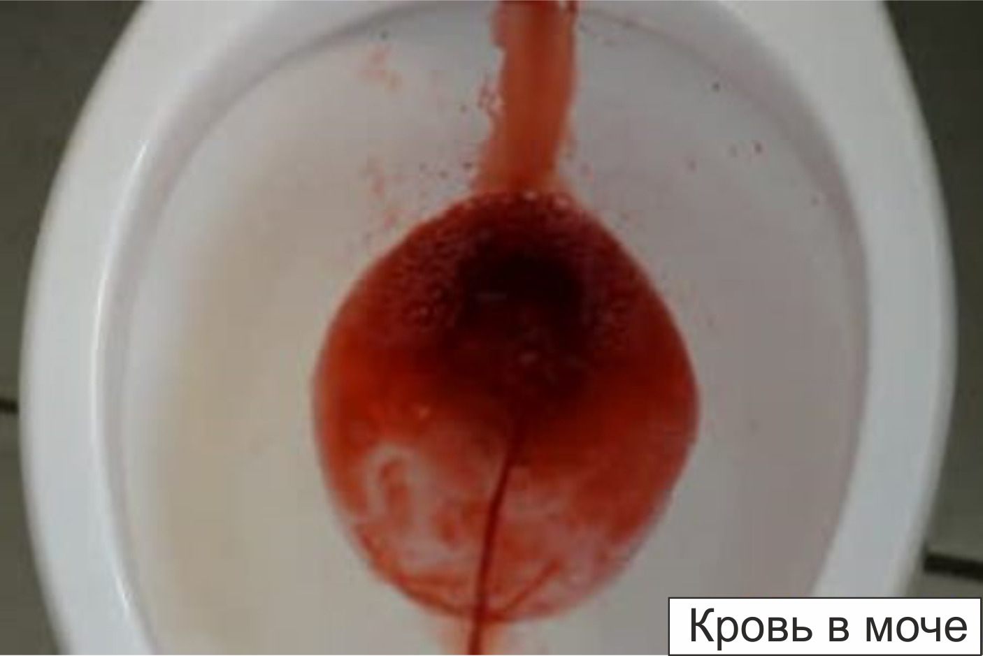 Ссу кровью ssu-krovyu