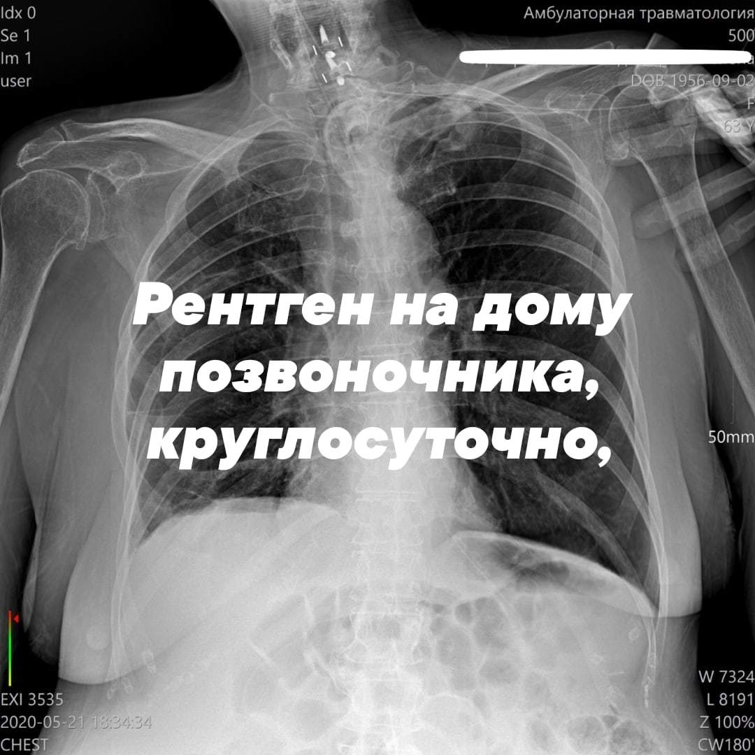 Платный рентген в москве. Платный рентген. Рентген на дому. Рентген на дому легкие. Рентген круглосуточно.